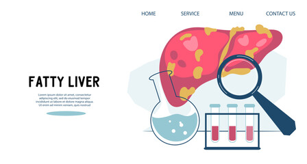 Fatty liver or hepatic steatosis disease poster or banner template for spreading health information and avoid pathology, flat vector illustration.