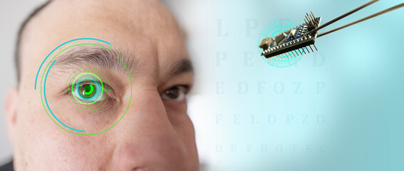 Installing electronic chip into human bionic, neuroprosthetic eye, cutting-edge technology,...