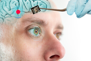 Installing electronic chip into human brain, applied in various fields neurotechnology and medical...