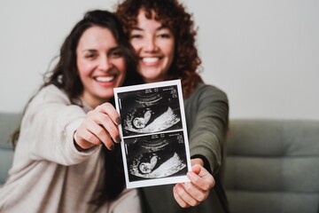 Happy gay lesbian couple holding ultrasound photo scan at home. Lgbt surrogate pregnancy concept