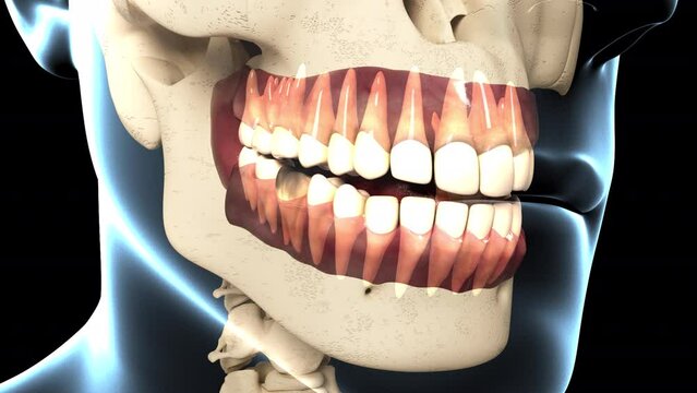 Dental Caries Overview