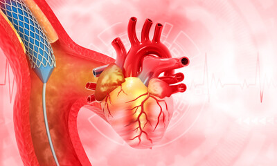 Cholesterol in human heart, Clogged blood vessels,3d illustration..