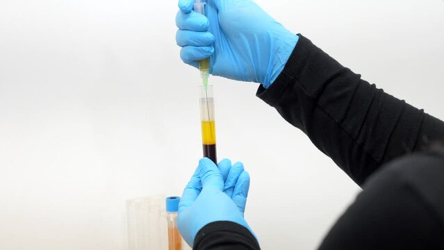 Close-up rear view of a woman in blue gloves extracting blood from tube sample in a dermatology lab for a baldness treatment