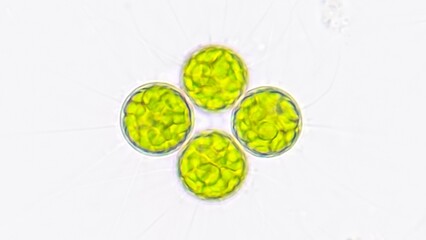 Freshwater microalgae, Golenkinia sp. Live cell. Selective focus image