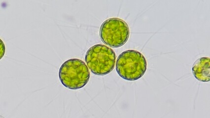 Freshwater microalgae, Golenkinia sp. Live cell. Selective focus image