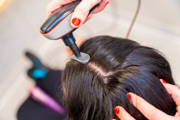 Woman receiving capillary treatment to combat hair loss
