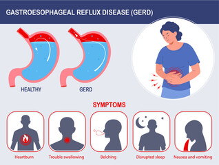 Gastroesophageal Reflux Disease (GERD) infographic. GERD symptoms. Medical info poster. Flat cartoon vector illustration	