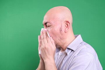 Side view of bald Asian man sneezing in tissue paper isolated on green background