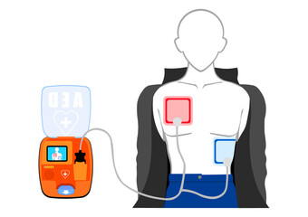 AED 自動体外式除細動器を取り付ける