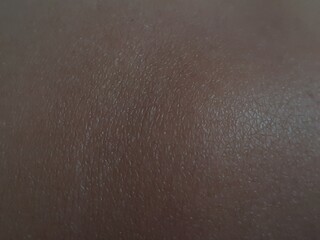 skin texture