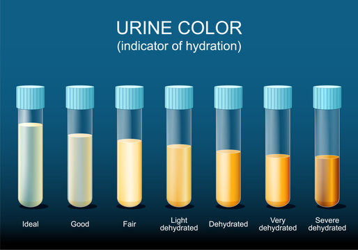 Test tubes with urine