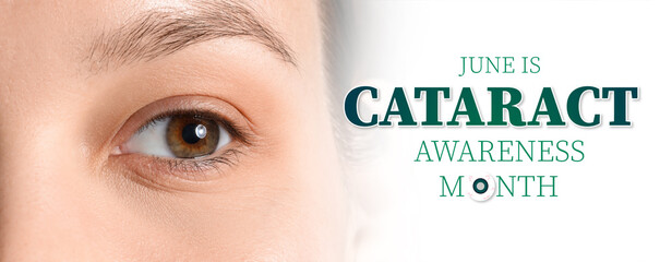 Eye of young woman, closeup. Banner for Cataract Awareness Month