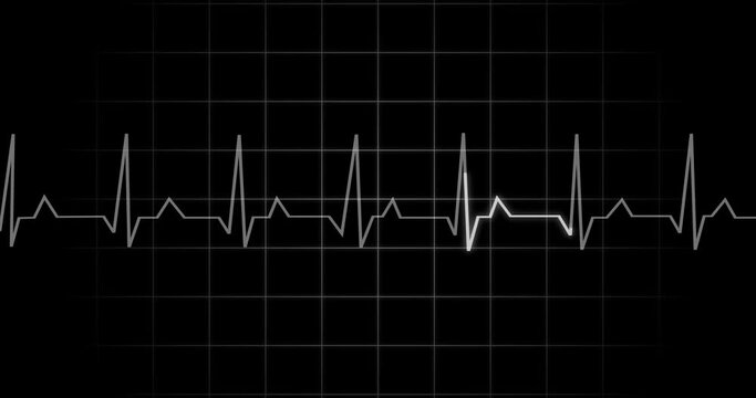 
EKG Heartbeat reading animation on black background in 4K. Medical monitor displaying cardiography pulse checkup diagnosis electronic screen display machine. Cardiogram nubes rate ecg waveform surger