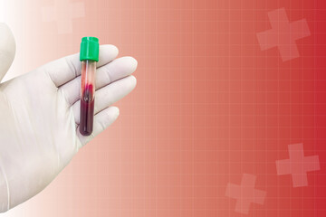 Blood test in the laboratory,The doctor's hands are wearing gloves and holding a clotted blood tube...