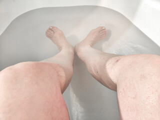 Close-Up of Varicose Veins on a Leg in the Bathtub. Leg with varicose veins while submerged in a bathtub, highlighting the health condition