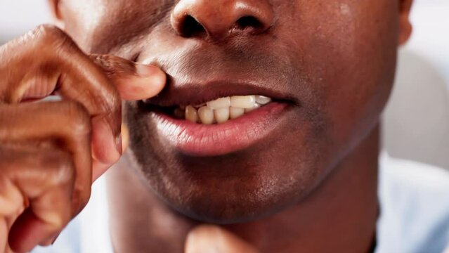 Man Chewing Wet Moist Nicotine Tobacco Snus