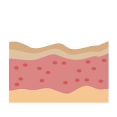 Human Skin Layer Illustration 