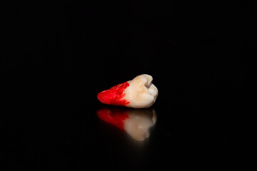Close-up of an extracted jaw teeth on a black background
