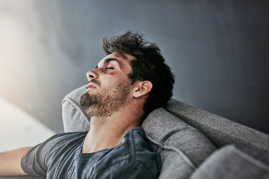 Domestic violence, danger or man sleeping with face bruise on sofa for depression, stress or fighting burnout. Facial, wound or addict unconscious in home with drug abuse, overdose or binge drinking
