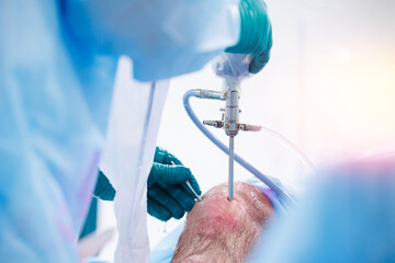 Surgeon use laparoscopic instrument for leg patient minimally invasive surgery. Suturing tendons...