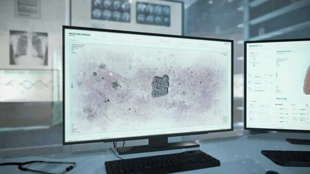 Animation of the infection microbe cell multiplication at the laboratory. Animation of the infection microbe spreading process. Animation of the infection microbe scientific research. Microbiology. UI
