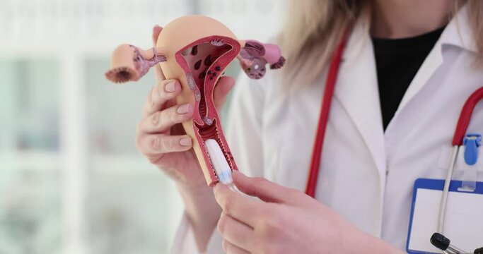 Gynecologist teaches process of inserting tampon during menstruation