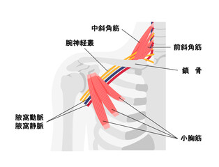胸郭出口症候群の発生する部位の図解 イラスト