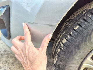 Finger indicating a scratch on a vehicles fender. Close-Up of a Scratched Car Fender With Finger...