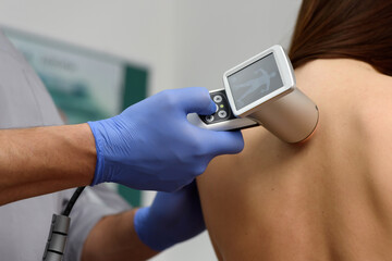 Digital dermatoscopy of moles. A dermatologist-oncologist examines the patient's moles using a dermatoscope. Prevention and early diagnosis of skin melanoma. Dermatological clinic. Close-up shot.