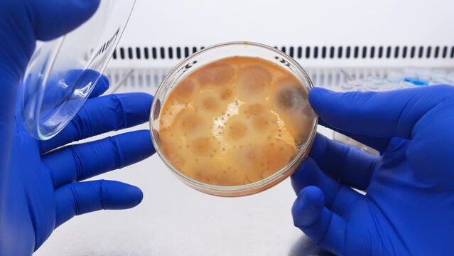 Isolation of pathogenic mold on a Petri dish in microbiology laboratory, the scientist opens the petri dish and turns it.