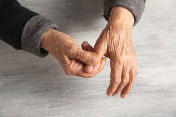 Caucasian elderly woman suffering from finger pain.