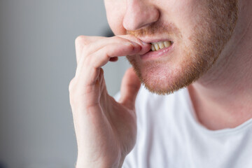 A man chewing his fingernails with a worried expression. Closeup.