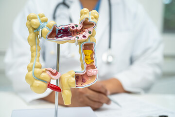 Intestine, appendix and digestive system, doctor holding anatomy model for study diagnosis and...