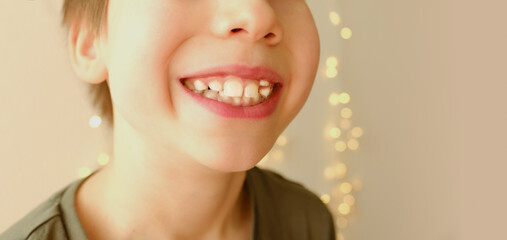 closeup crooked teeth, boy 9-10 years opened mouth, child 8 years old shows teeth, visit to dentist...