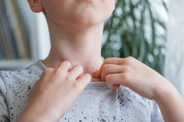 close-up neck, caucasian child patient holding affected area, experiencing throat pain, loss of...