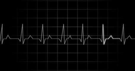 EKG Heartbeat reading animation on black background. Medical monitor displaying cardiography pulse checkup diagnosis electronic screen display machine. Cardiogram nubes rate ecg waveform surgery.