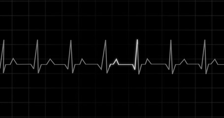 Naklejka premium EKG Heartbeat reading animation on black background. Medical monitor displaying cardiography pulse checkup diagnosis electronic screen display machine. Cardiogram nubes rate ecg waveform surgery.