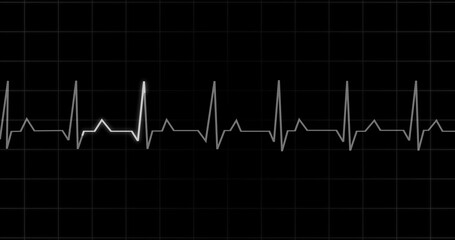 EKG Heartbeat reading animation on black background. Medical monitor displaying cardiography pulse checkup diagnosis electronic screen display machine. Cardiogram nubes rate ecg waveform surgery.