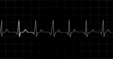 EKG Heartbeat reading animation on black background. Medical monitor displaying cardiography pulse checkup diagnosis electronic screen display machine. Cardiogram nubes rate ecg waveform surgery.