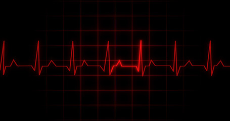 EKG Heartbeat reading animation on black background. Medical monitor displaying cardiography pulse checkup diagnosis electronic screen display machine. Cardiogram nubes rate ecg waveform surgery.