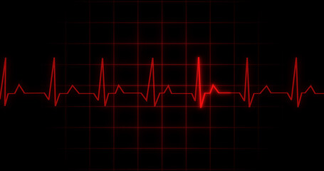 EKG Heartbeat reading animation on black background. Medical monitor displaying cardiography pulse checkup diagnosis electronic screen display machine. Cardiogram nubes rate ecg waveform surgery.