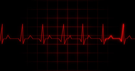 EKG Heartbeat reading animation on black background. Medical monitor displaying cardiography pulse checkup diagnosis electronic screen display machine. Cardiogram nubes rate ecg waveform surgery.