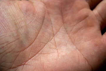 Fototapeta premium Human hand. Male skin pattern. Dermatology background. Health skin.