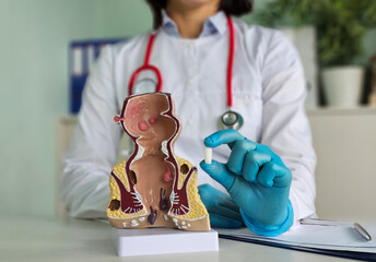 Medical suppository with laxative medicine or for treatment of proctological diseases concept
