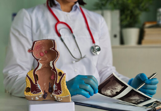 Doctor rectal examination and transrectal ultrasound