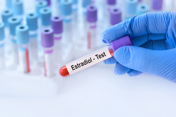 Doctor holding a test blood sample tube with Estradiol test on the background of medical test tubes with analyzes.