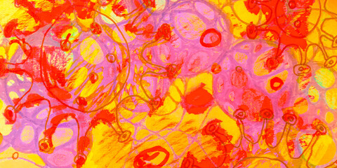 Anti-Bacteria. White Lymphoma Cells. Yellow Macro