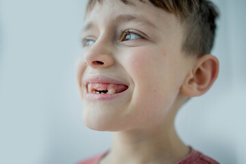 Kid losing a baby tooth and a new permanent tooth coming out