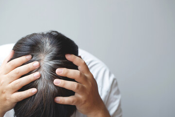 Top view of young people premature gray hair, showing black hoary hair roots on head change to...