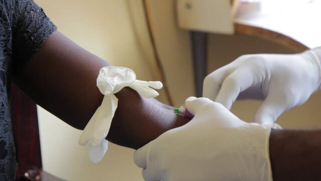 A health worker taking a blood sample from the cubital vein by piercing the vein (venipunture) and collecting blood into a test tube under negative pressure (vacuum).